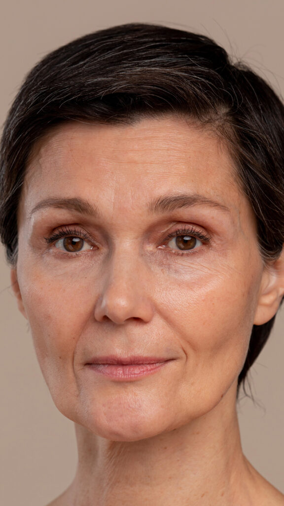Vorher-Bild einer Frau vor Aquafacial-Behandlung – The Beauty Bar